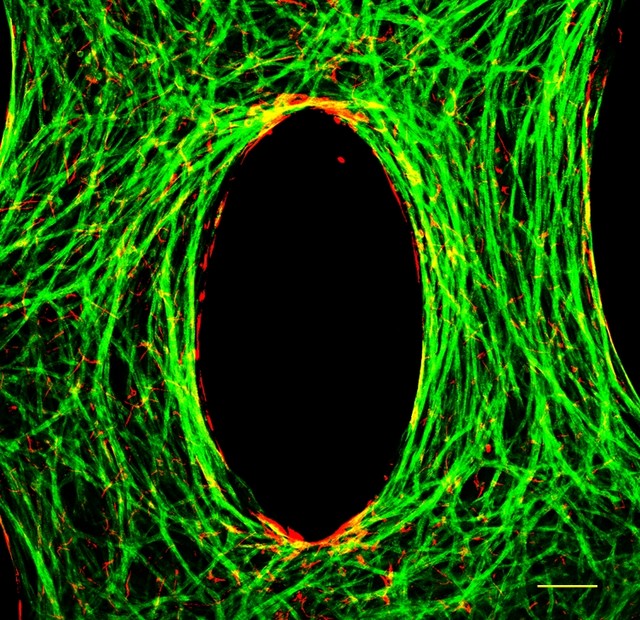 Immunofluorescence staining image showing the cardiomyocytes in green and the fibroblasts interspersed around them in red. Note the alignment of the cells around the central pore.