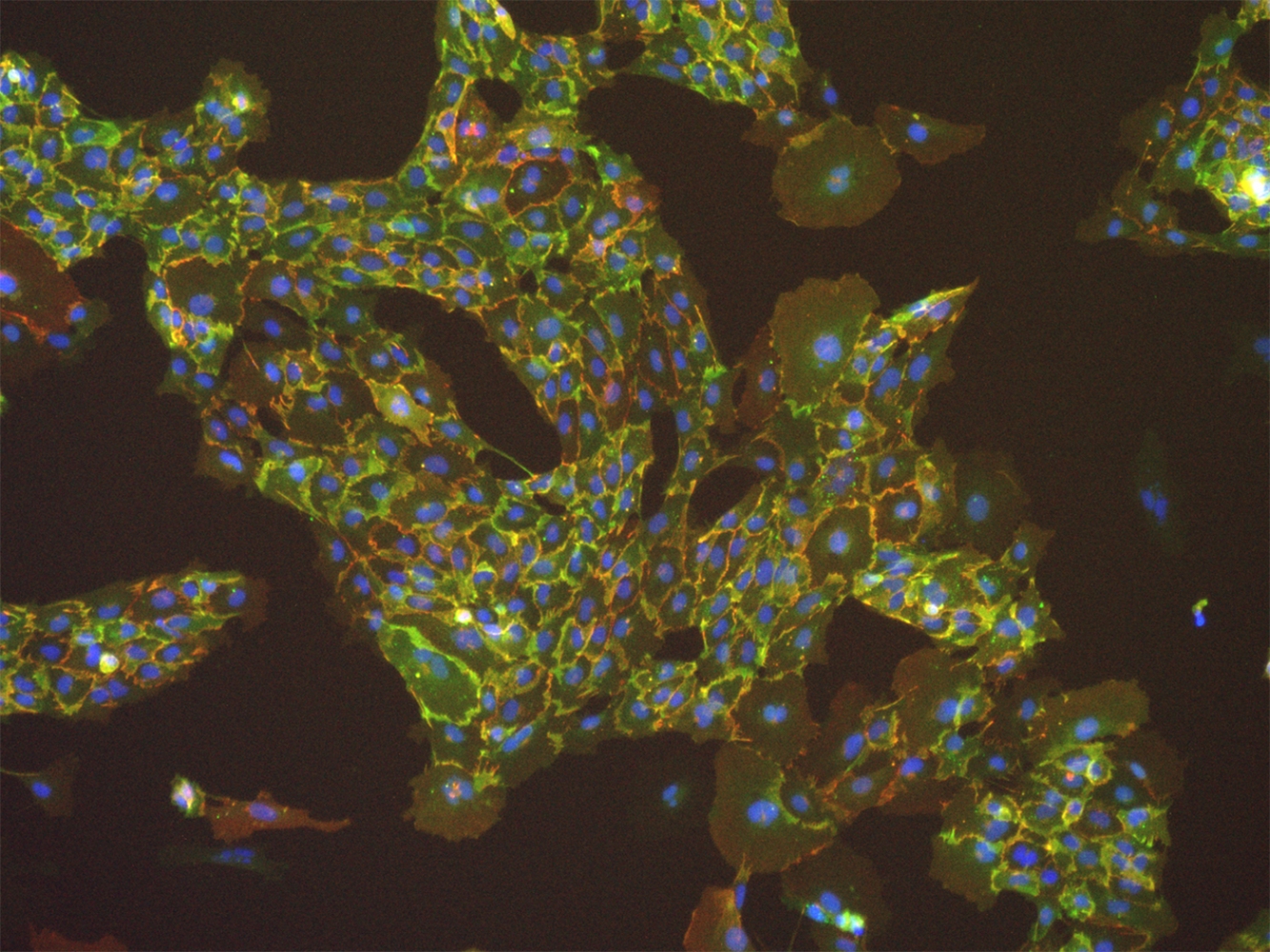 The image shows human endothelial cells derived from human induced pluripotent stem cells