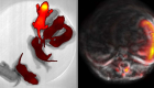 A color-changing mouse model was developed for deep-tissue organ-specific optogenetic control (left) and photoacoustic imaging (right). 