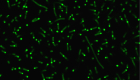 Long, thin, neon green cells with small bright spots 