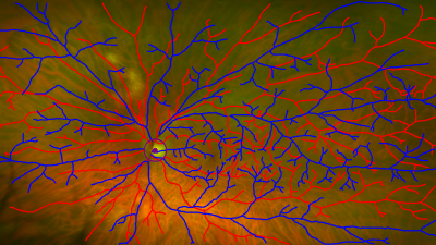 eye neurons