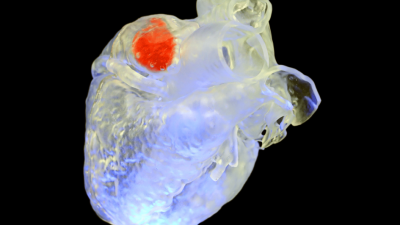 A specialized ink hardens when exposed to focused ultrasound waves on a 3D model of the human heart