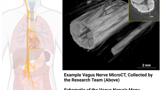 Schematic showing vagus nerve