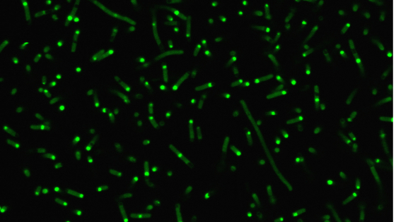 Long, thin, neon green cells with small bright spots