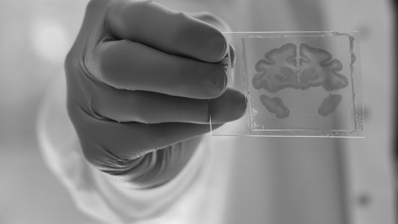 A researcher holds a slide showing a slice of a brain sample
