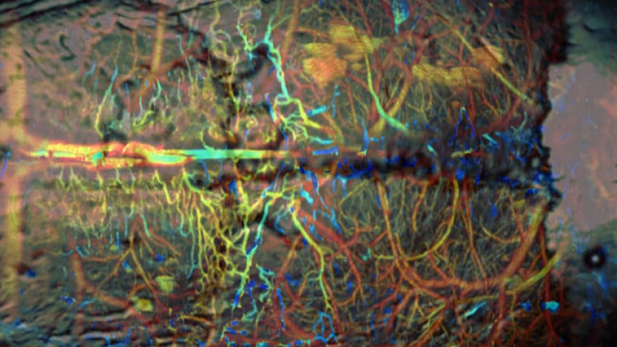 A look at neurons in the brain using photoacoustic tomography