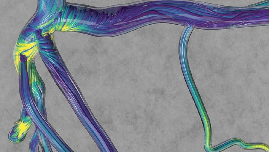 colorful rendition of the forces at work within the human vascular system