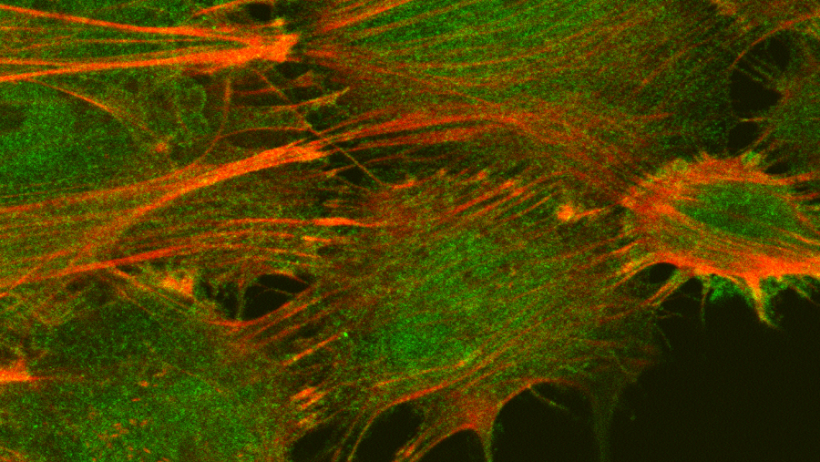 Human podocytes, a type of kidney cell, on electrospun mats