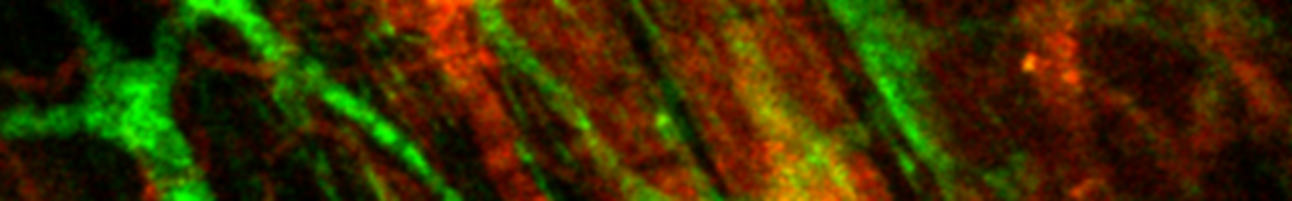 microscope image from Shen lab