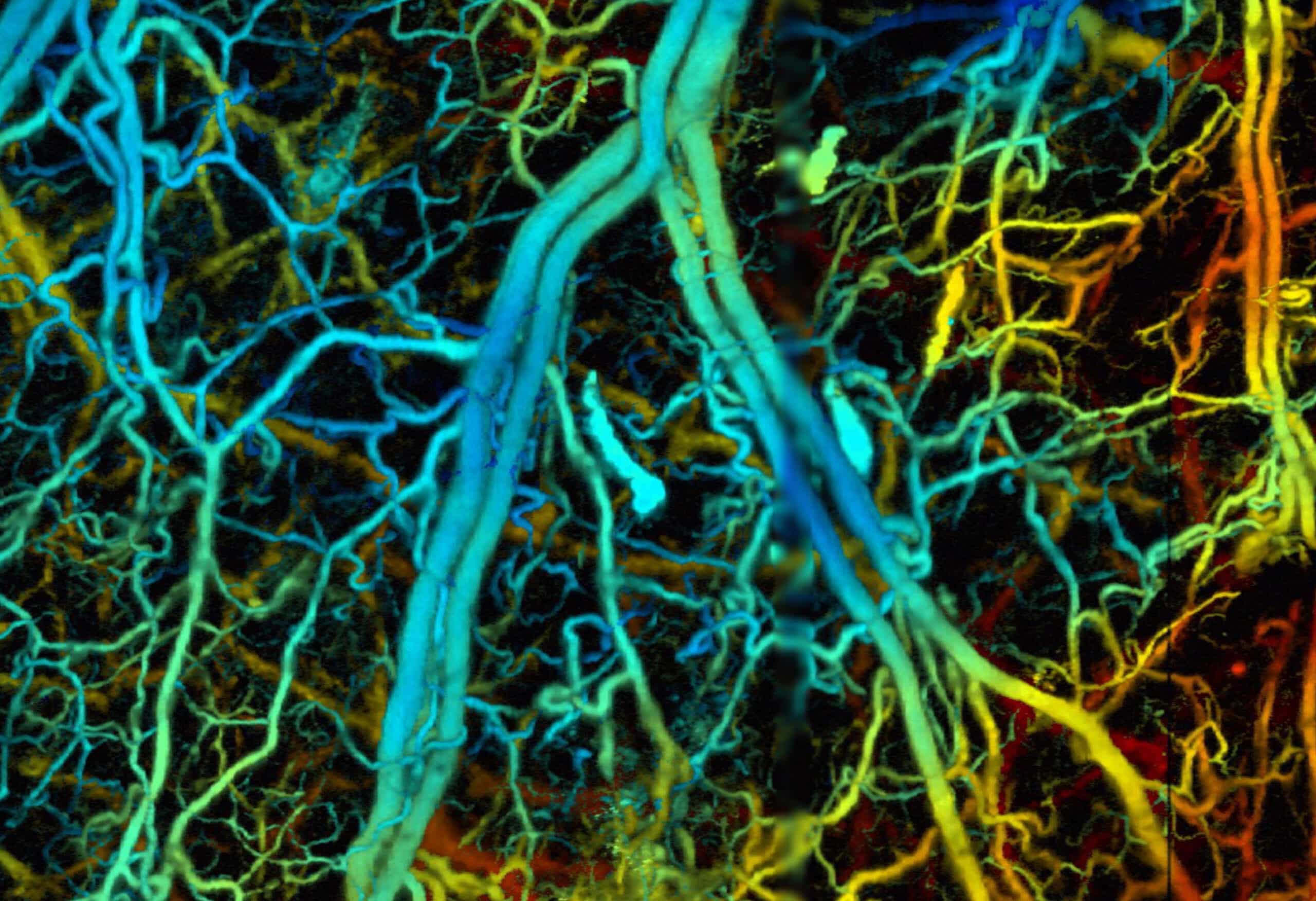 photoacoustic microscopy of mouse ear vasculature