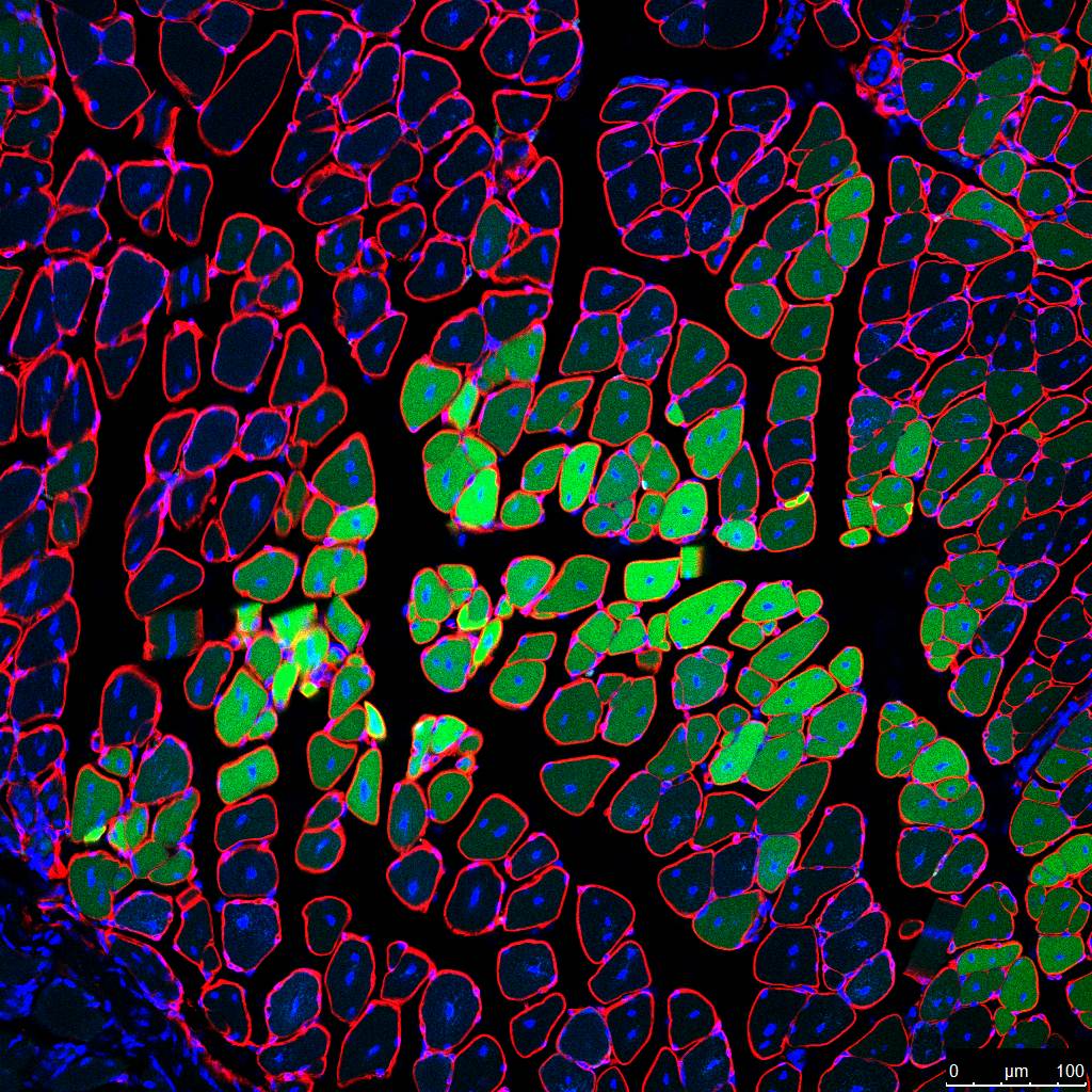 microscope image of muscle from Gersbach lab