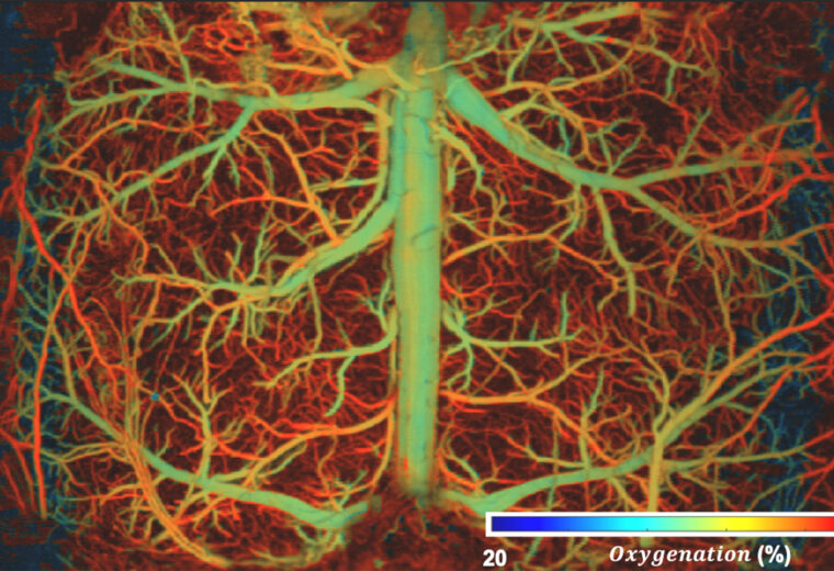 photoacoustic image of vasculature