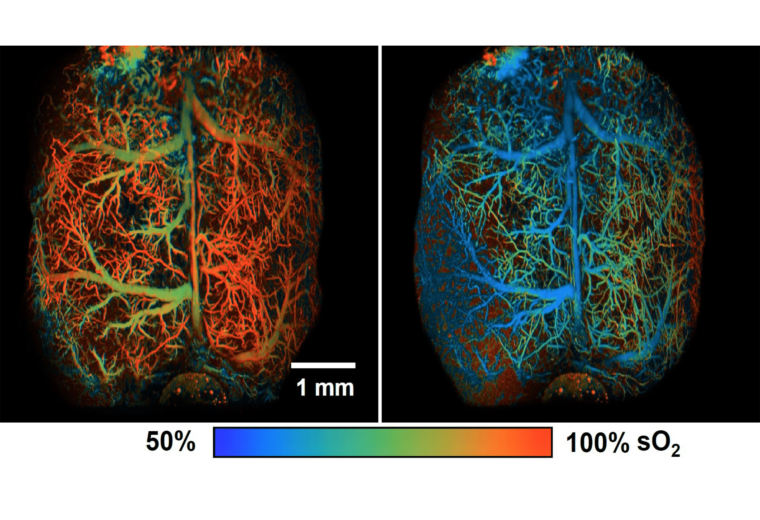 A graphic showing the effect of epinephrine on a mouse brain.