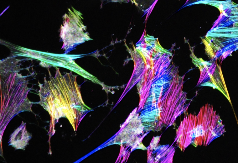abstract patterns of streaks of yellow, pink and blue against a dark background