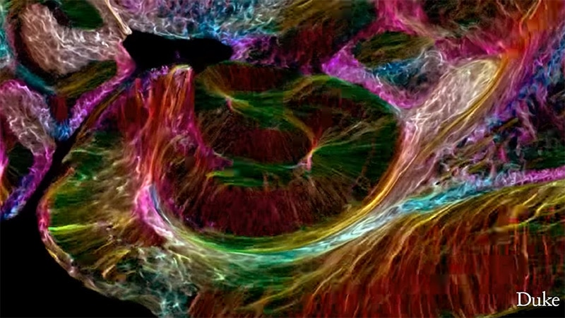 A web of tangled, flowing colors that follow the neural pathways of a mouse brain