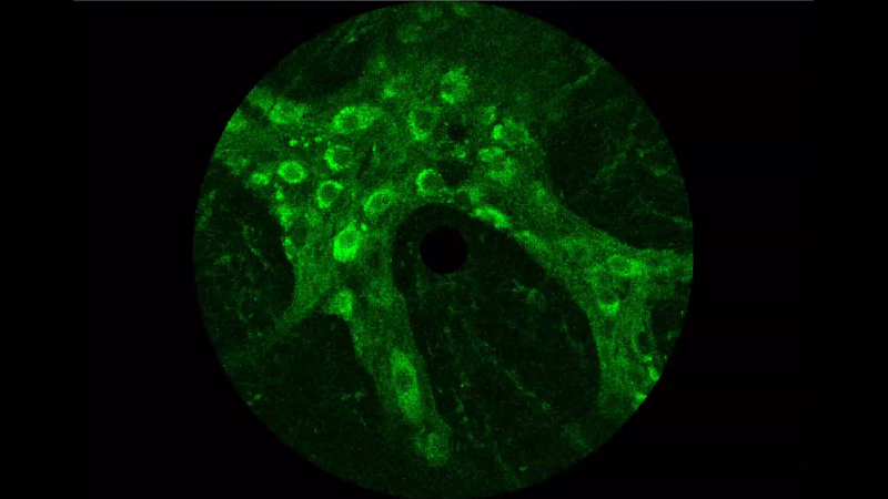 A circlular microscope view of green tendrils filled with small splotches - stained neurons inside a colon