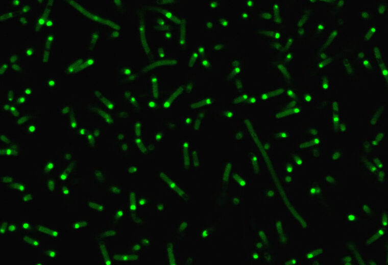 Long, thin, neon green cells with small bright spots