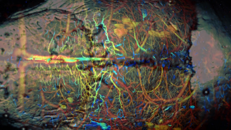 A look at neurons in the brain using photoacoustic tomography